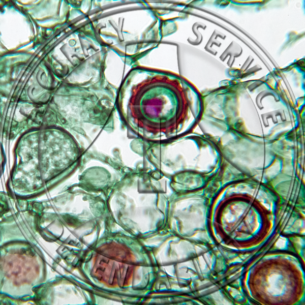 Albugo candida Oospores Prepared Microscope Slide