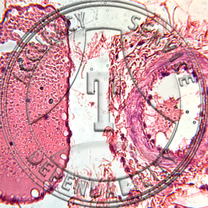 Artery Vein Capillary Slide HG2-11 Artery, vein & capillaries; section.