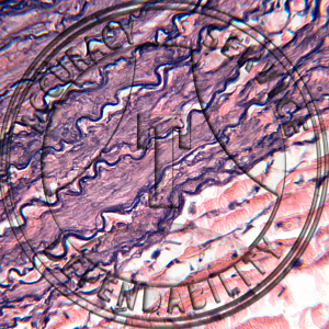 Artery Vein Capillary Slide HG2-113 Artery, vein & capillaries; elastic tissue stain, section.