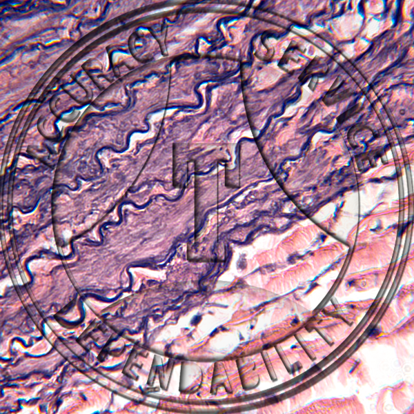 Artery Vein Capillary Slide HG2-113 Artery, vein & capillaries; elastic tissue stain, section.