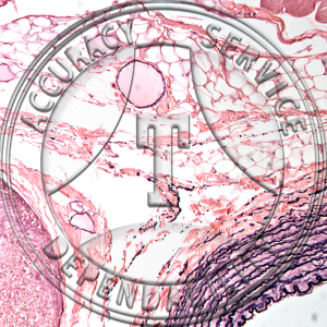 Artery Vein Nerve Slide HG2-123 Artery, vein & nerve; section, elastic tissue stain.