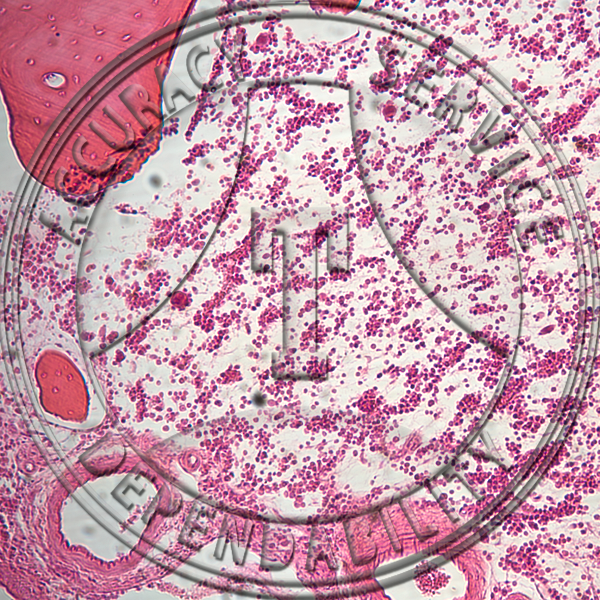 Bone Slide HB8-31 Bone; decalcified, cs.