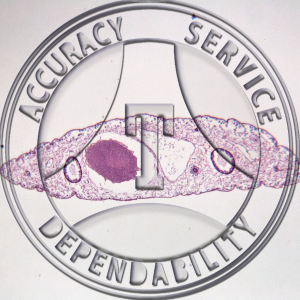 Chlonorchis Slide ZD2-11 Trematoda Clonorchis sinensis; 3 regions, cs.