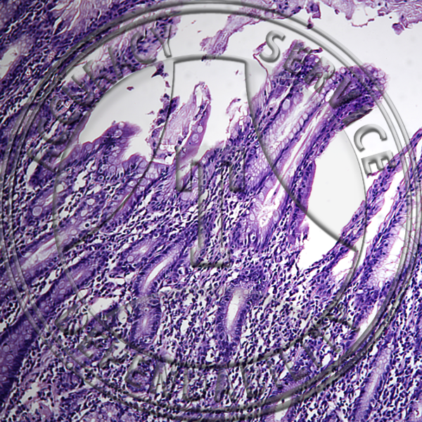 Duodenum Slide HK7-211 Duodenum: human, section