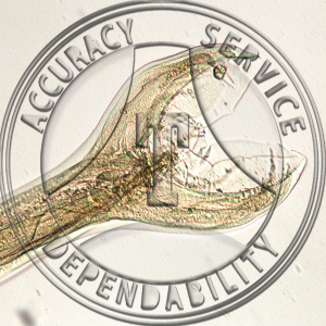 Hookworm Slide ZE3-11 Ancylostoma caninum (hookworm); male, wm.