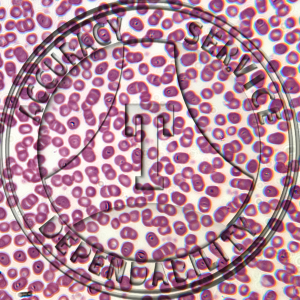 Human Blood Slide HC1-400 Normal human blood smear; erythrocytes, leukocytes, & platelets well differentiated. H&e stain.