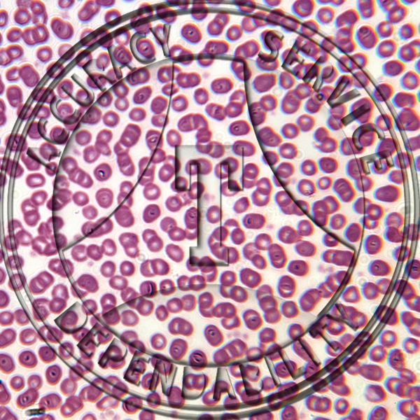 Human Blood Slide HC1-400 Normal human blood smear; erythrocytes, leukocytes, & platelets well differentiated. H&e stain.