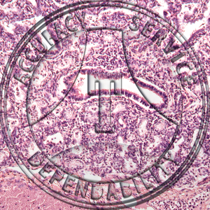 Human Lung Slide HJ1-221 Lung; fetal human, section.
