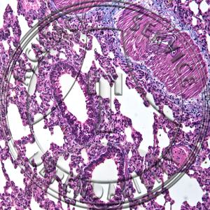 Human Lung Slide HJ1-2T Lung; trichrome stain