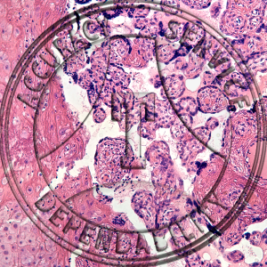 Human Placenta Slide HN4-1 Genital system: female placenta; human, section.