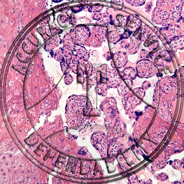 Human Placenta Slide HN4-1 Genital system: female placenta; human, section.