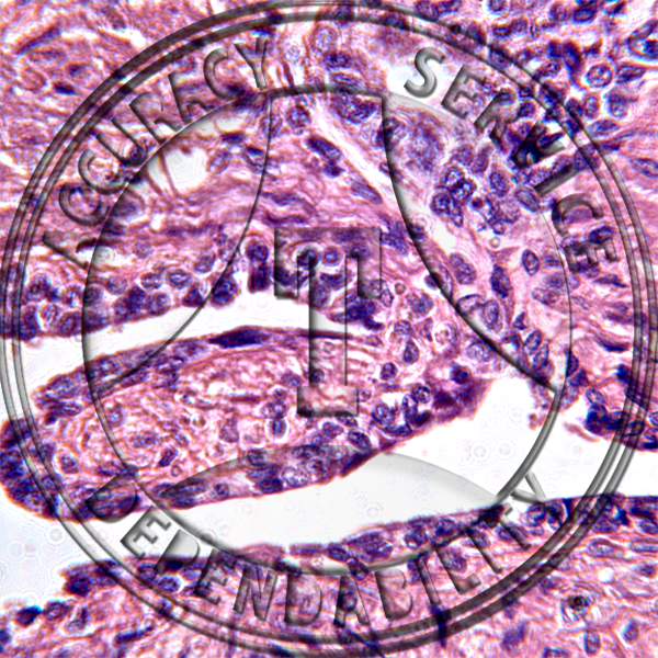 Human Seminal Vesicle Slide HM4-21 Genital system: male seminal vesicle; human, cs.