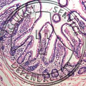 Ileum Slide HK7-231 Ileum; human, section.