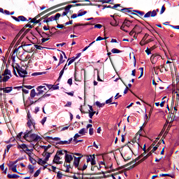 Intramembranous Bone Slide HB8-2 Developing intramembranous bone; section of fetal skull.