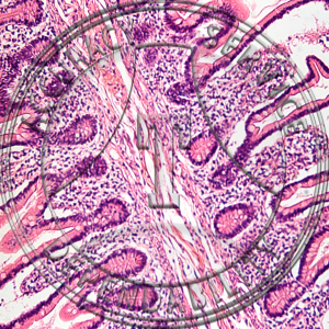 Jejunum Slide HK7-221 Jejunum; human, section.