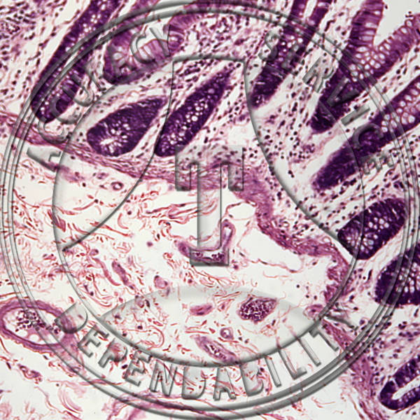 Large Intestine Slide HK8-21 Large intestine (colon); human, section.