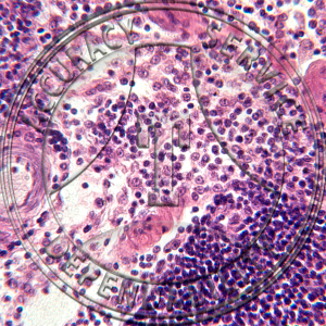 Lymph Node Slide HH1-3 Lymph node; section.