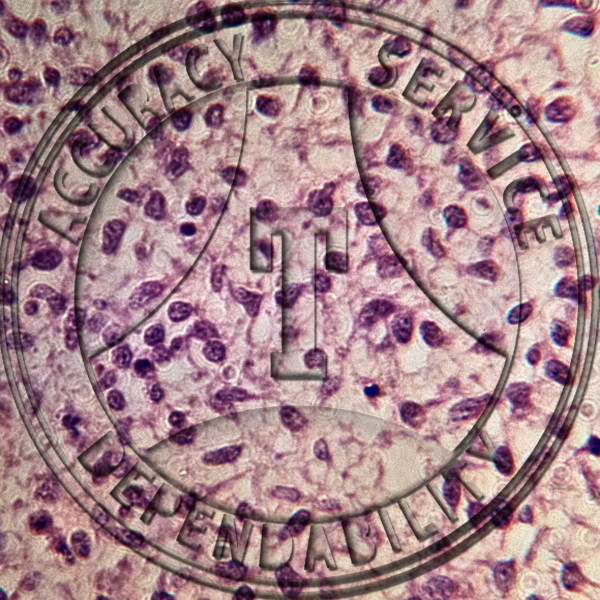 Mesenchyme Slide HB1-12 Mesenchyme (embryonic connective tissue); section.