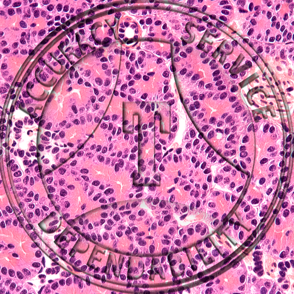 Necturus Pancreas Slide ZL8-22 Necturus; pancreas, section.