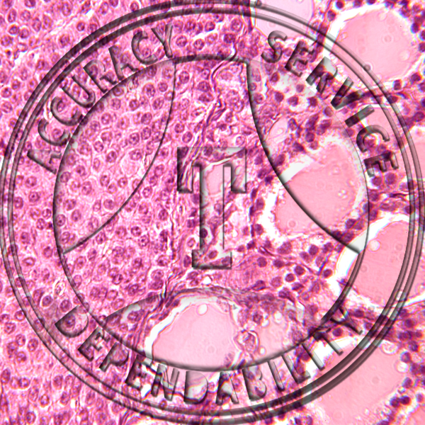 Parathyroid & Thyroid Prepared Microscope Slide