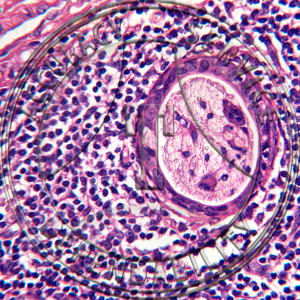 Pharyngeal Tonsil Slide HH1-21 Pharyngeal tonsil (adenoid); human, section.