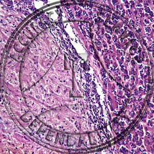 Pituitary Slide HO1-1 Hypophysis (pituitary); section, anterior & posterior lobes.