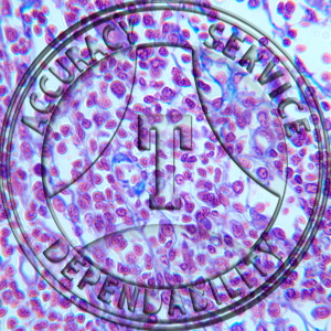 Reticular Tissue Slide HB6-5 Reticular tissue; lymph node, section.