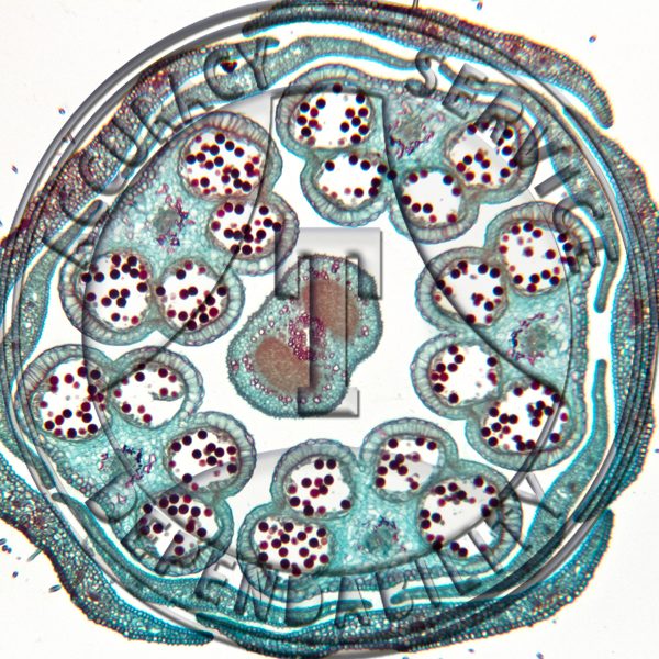 Ribes americanum Bud Prepared Microscope Slide