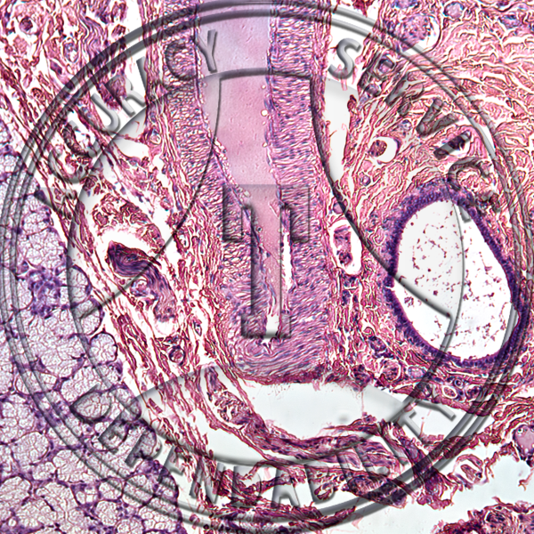 Salivary Gland Slide HK4-51 Salivary glands; 3 types, serous, mucous, & mixed, section.