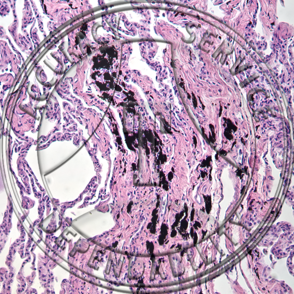 Smokers Lung Prepared Microscope Slide