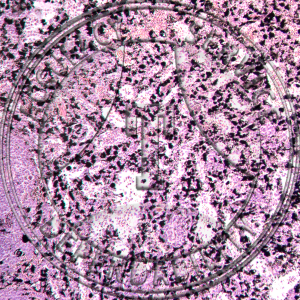 Spleen Slide HH1-44 Spleen; section showing phagocytic cells filled with carbon.