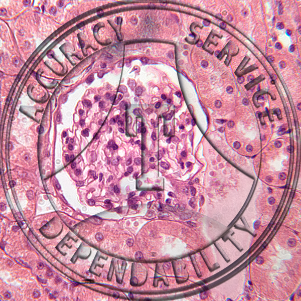 Squamous Epithelium Slide HA1-3 Squamous epithelium; kidney (bowman's capsule), section.