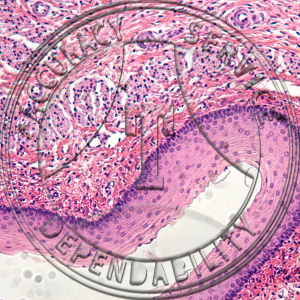 Squamous Epithelium Slide HA4-22 Stratified squamous epithelium; esophagus, section.