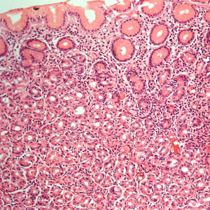 Stomach Slide HK6-231 Stomach; fundic region, human, section.