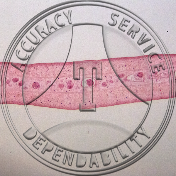 Taenia Tapeworm 3 Proglottid Section Prepared Microscope Slide Section 2