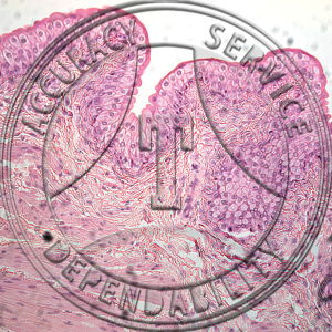 Transitional Epithelium Slide HA5-1 Transitional epithelium; ureter or bladder, section.