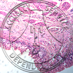 Transitional Epithelium Slide HA5-11 Transitional epithelium; human, section of ureter or bladder.