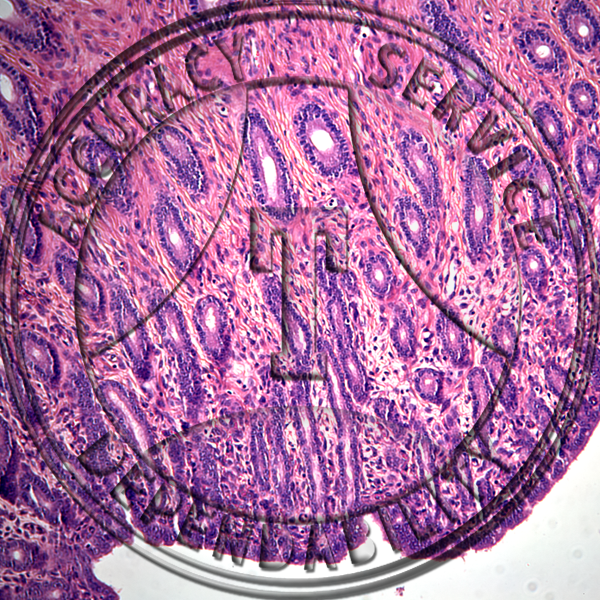 Uterus Slide HN2-32 Genital system: female uterus; mature, cs.