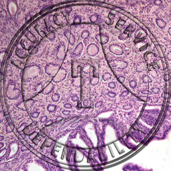 Uterus Slide HN2-321 Genital system: female uterus; pregnant mammal, section.