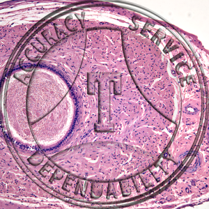 Vas Deferens Slide HM4-1 Genital system: male vas deferens; cs.