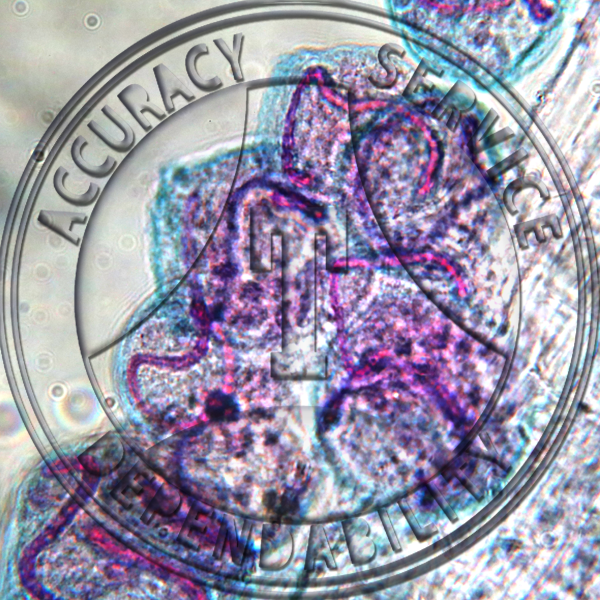 Vorticella Slide ZA4-5 Ciliata Vorticella; wm. Feulgen stain clearly demonstrates twisted, elongate nuclei.