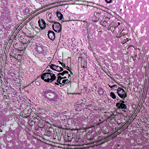 ZD5-44 Schistosoma mansoni Human Liver Egg Infection Prepared Microscope Slide