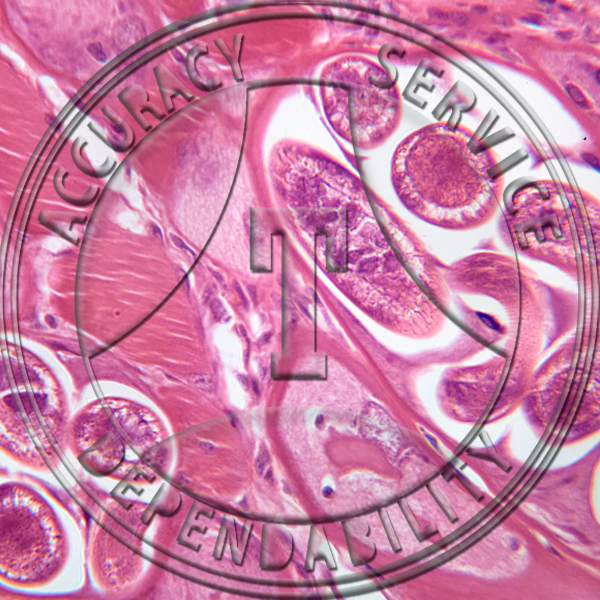 ZE4-13 Trichinella spiralis Encysted Larvae Prepared Microscope Slide