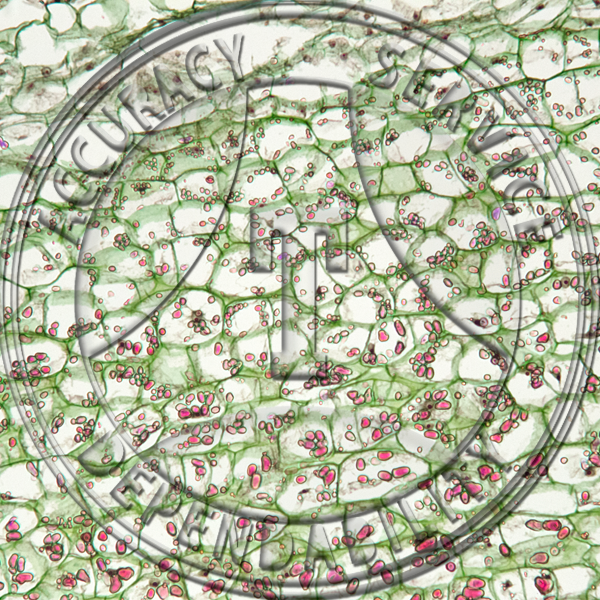 Solanum tuberosum Young Tuber CS Prepared Microscope Slide