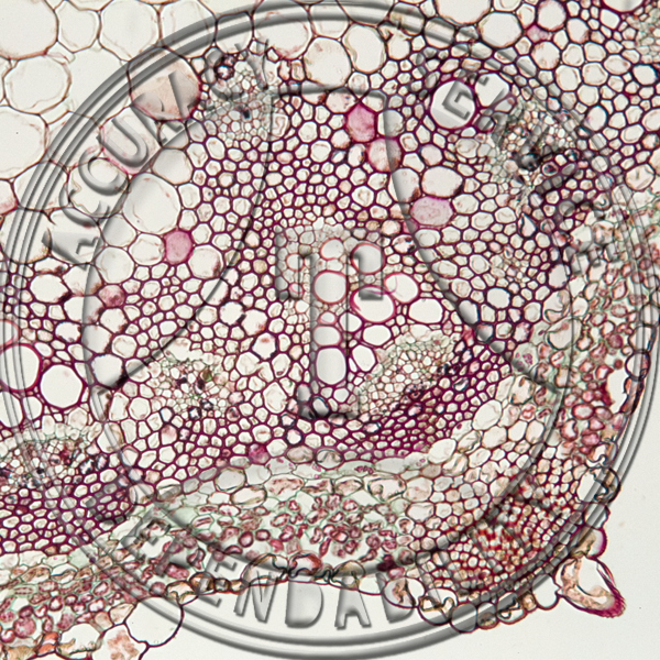 Rumex crispus Stem CS Prepared Microscope Slide