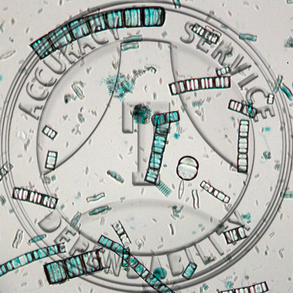 Freshwater Diatom Prepared Microscope Slide