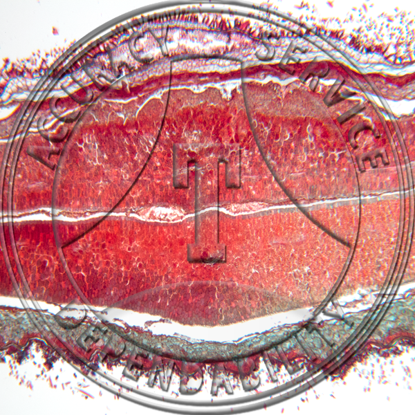 Strophanthus kombe Seed Prepared Microscope Slide