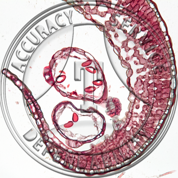 Pellaea glabella Leaflet Cs Attached Sporangia Prepared Microscope Slide