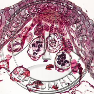 Polypodium polypodioides Leaflet CS Attached Sporangia Prepared Microscope Slide