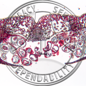 Polystichum acrostichoides Leaflet CS Sorus Prepared Microscope Slide